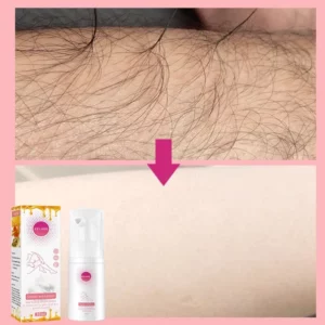 Mousse Hair Removal Spray