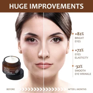 Retinol eye cream, instantly remove eye bags and anti-aging