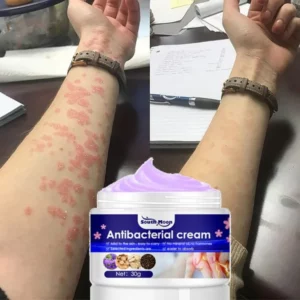 Herbal Anti-bacterial Cream