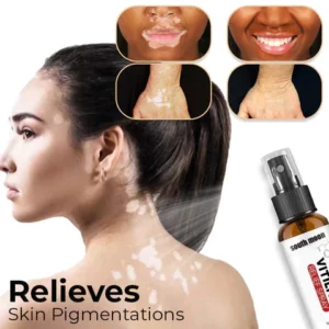 Herbal Vitiligo Relief Spray
