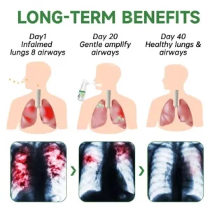 RespiClean Herbal Lung and Breath Spray