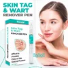 Tiworld™Skin Tag & Wart Remover Pen