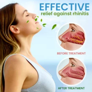 Rhinitis Relief Cream