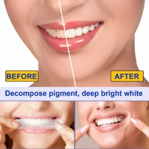 Teeth Whitening Strips