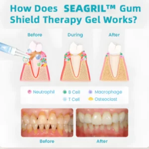 SEAGRIL™ Gum Shield Therapy Gel