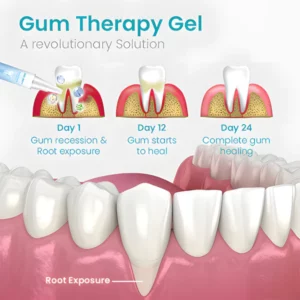 SEAGRIL™ Gum Shield Therapy Gel