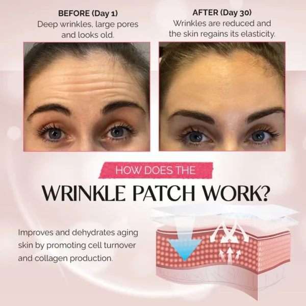 LineLess™ Forehead & Between Eyes Wrinkle Patch