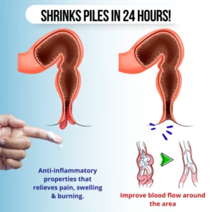 Hemorrhoid & Fissure Cream