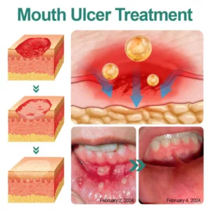 Dobshow™ Ultra Healing Herbal Mouth Spray 2024