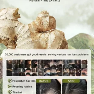 ✨Last Day Promotio🎁Hot Sale Ginger Plant Extract Anti-Hair Loss Hair Shampoo