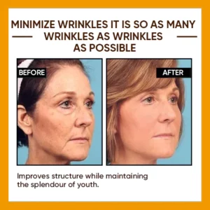 Skip the Line Instant Wrinkle Eraser