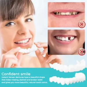 Dobshow™ ProX adjustable snap-on dentures