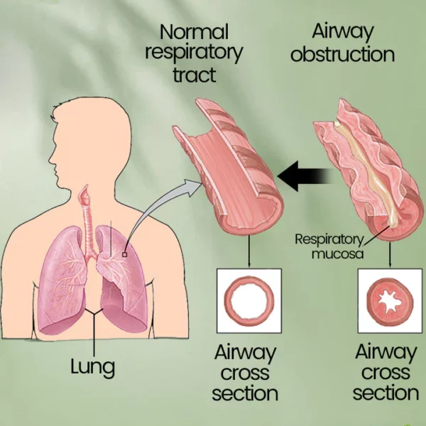 Herbal Lung Cleanse and Repair Mist