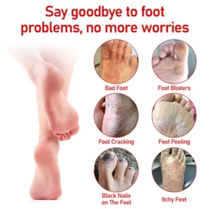 Medical nail fungus foot spray