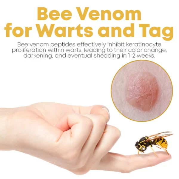 ClearSkin Bee Venom Wart and Tags Removal Spray