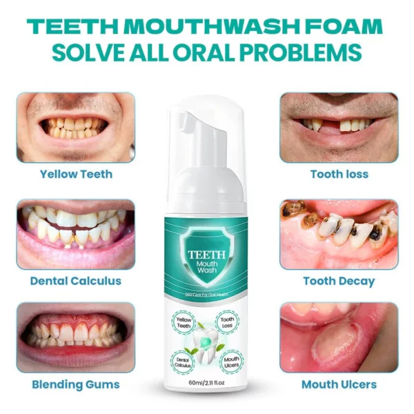 TEETH Mouthwash Foam