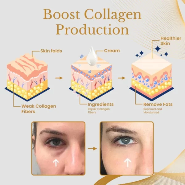 Ceoerty™ AgeErase Collagen Eye Cream