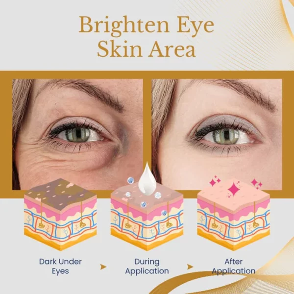 Ceoerty™ AgeErase Collagen Eye Cream