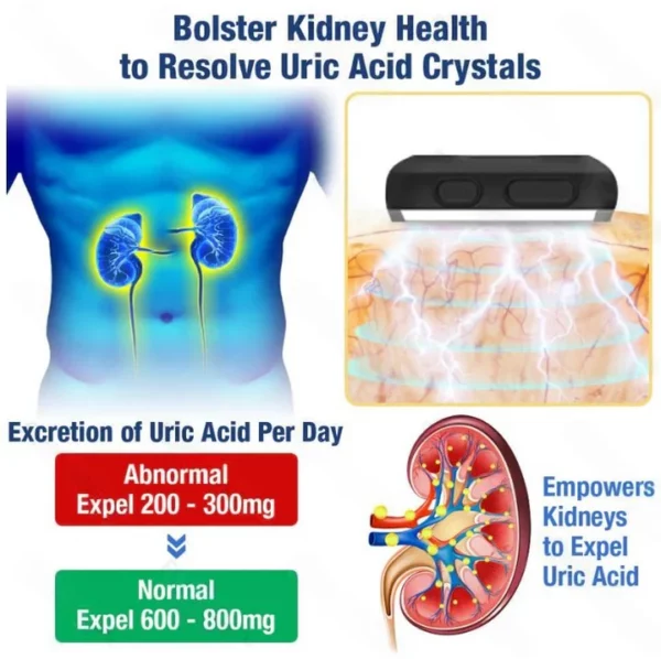 UricEase Microcurrent Therapy Device