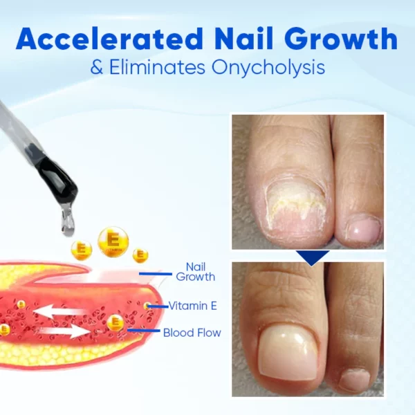 SEAGRIL™ OnyxoGuard Nail Growth and Repair Serum