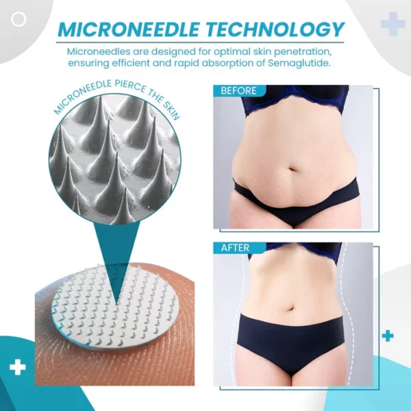 Semaglutide Microneedle Patches