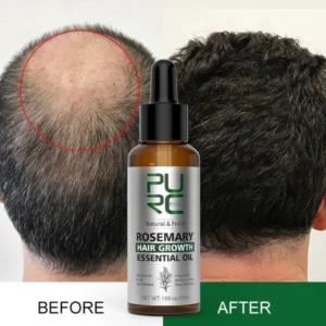 Revitalize with PURC Rosemary Oil For Hair Growth
