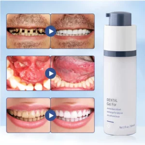 Teeth Whitening Repair Regrowth Dental Gel