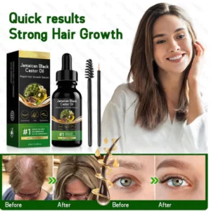 Jamaican Black Castor Oil Rapid Hair Growth Serum