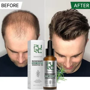 Revitalize with PURC Rosemary Oil For Hair Growth