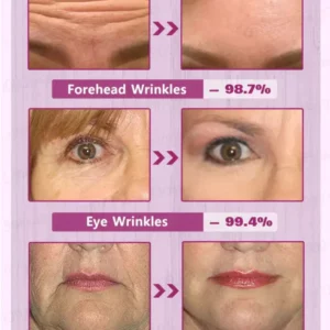 Skip the Line Instant Wrinkle Eraser