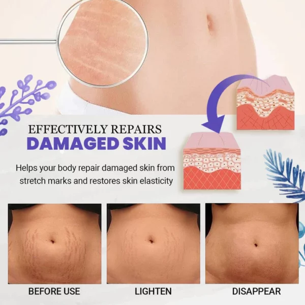 EarthBlend™ Stretch Mark Vanisher