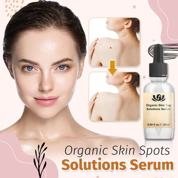 Organic Skin Spot Solutions Serum