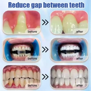 Loose Teeth Care Toothpaste