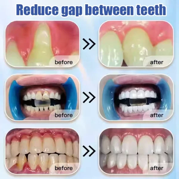 Loose Teeth Care Toothpaste