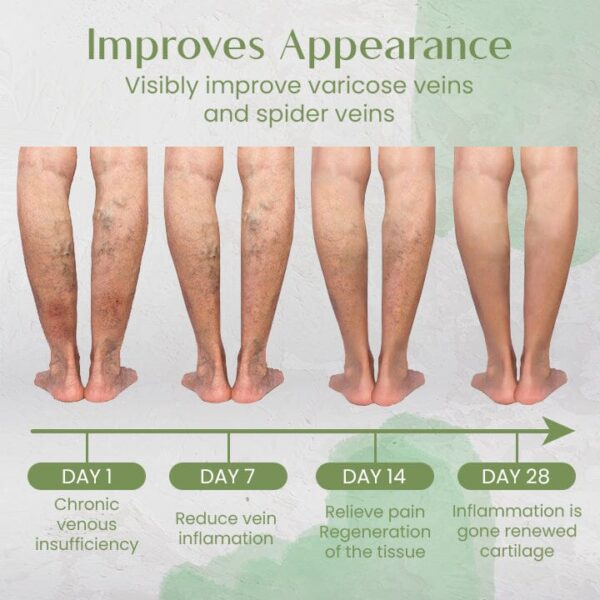 VeinCare Varicose Treatment Spray