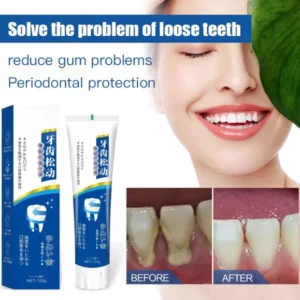 Loose Teeth Care Toothpaste