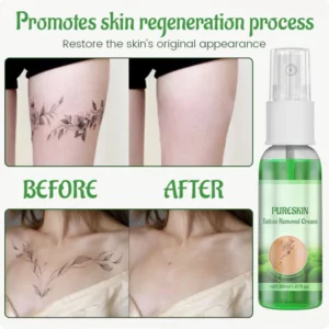 PureSkin Tattoo Removal Cream