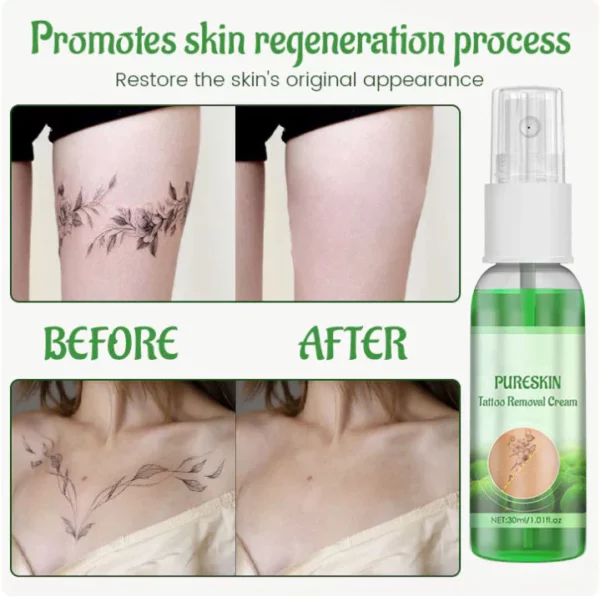 PureSkin Tattoo Removal Cream