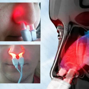 BreatheBright Nasal LED Therapy Device