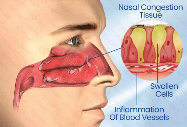 BreatheBright Nasal LED Therapy Device