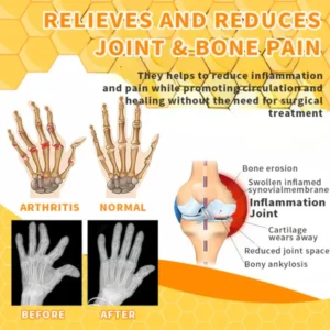 TAILEDEN™ Bee Venom Joint Therapy Pain Relief Gel