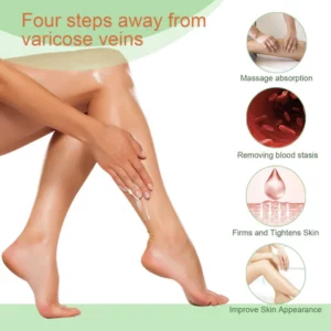 Negusy® Veins Cream: Complete Treatment for Varicose Veins