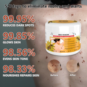 Posryst™ Bee Venom Mole and Wart Treatment Cream