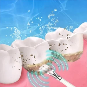 Best gift for family and friends - Electric Ultrasonic tooth cleaner