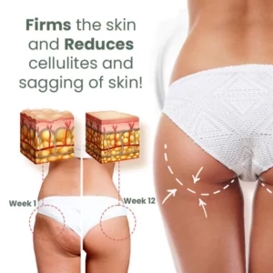 Seurico™ Wormwood Cellulite Be Gone Skin Tighten Cream