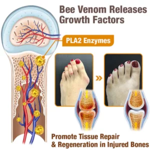 FLYSMUS™ GOUT BEE VENOM TREATMENT CREAM