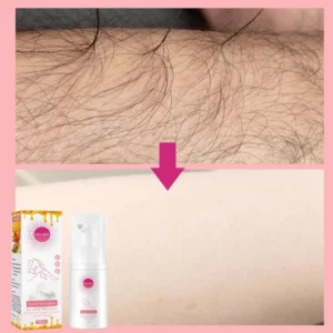 CLEARANCE SALE - Mousse Hair Removal Spray