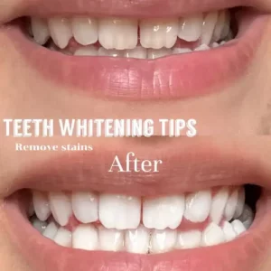 Teeth Whitening Powder | Instant Whitening and Stain Removal