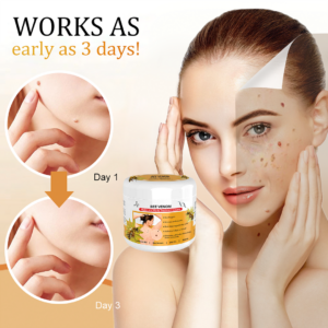 Posryst™ Bee Venom Mole and Wart Treatment Cream