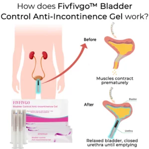 Fivfivgo™ Bladder Control Anti-Incontinence Gel